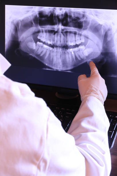 Best Emergency Dental Care for Abscessed Tooth in Murray, UT